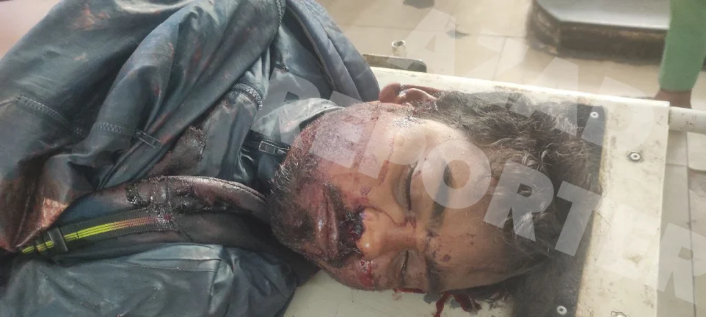 Sakchi jail cleaning worker met with a road accident in Dugni