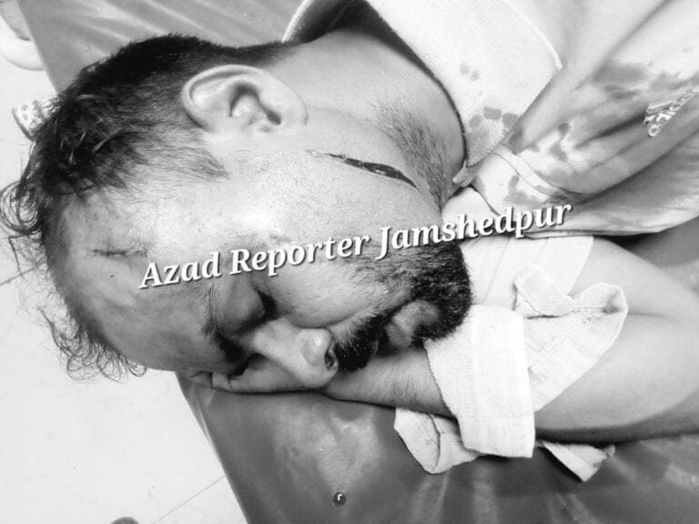 Attack With Weapon In Barinagar Telco, 2 Men Injured