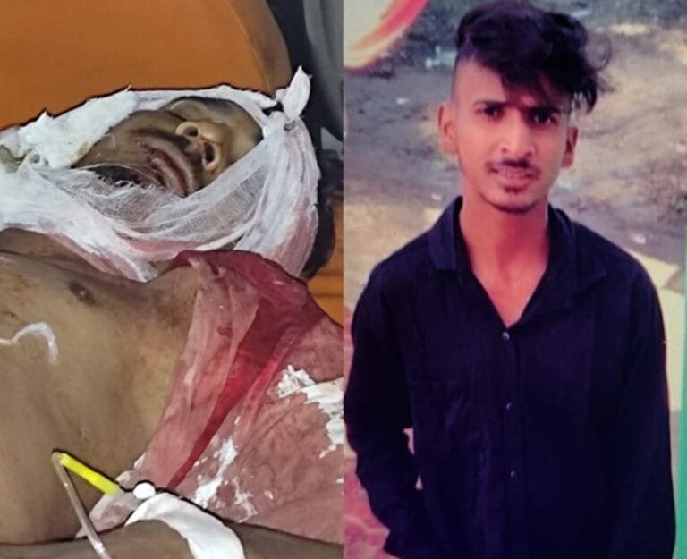 Handicapped Young Man Deadily Attacked In Birsanagar Jamshedpur