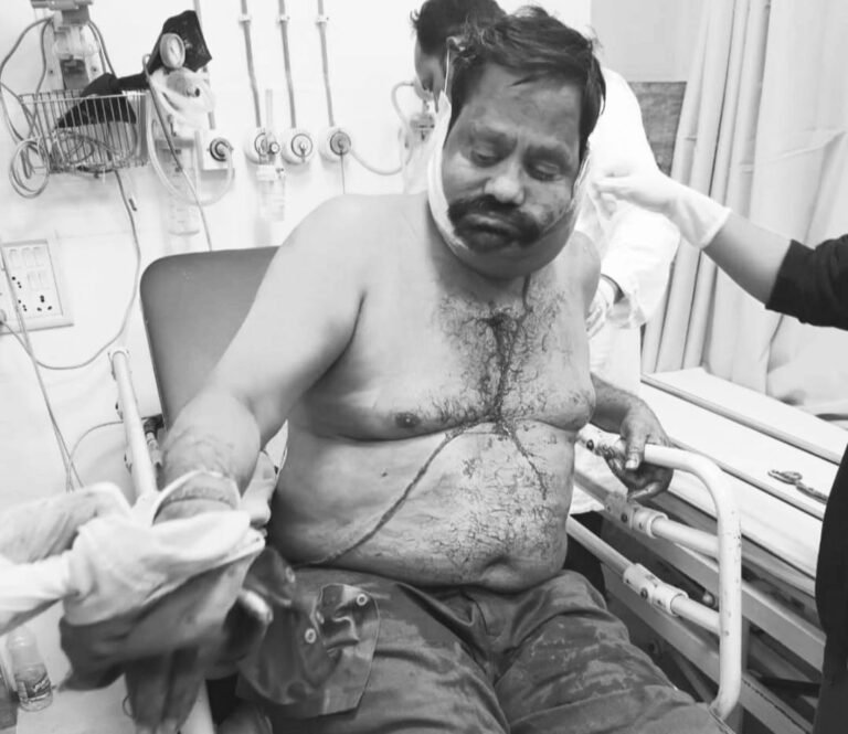 Jamshedpur News : डिमना रोड पर धारदार हथियार से हमला, राजीव चंद्र त्रिवेदी गंभीर रूप से घायल