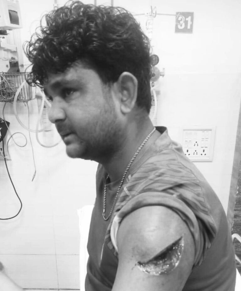 जमशेदपुर में फाइनेंस कंपनी के एजेंट ने युवक पर किया चापड़ से हमला