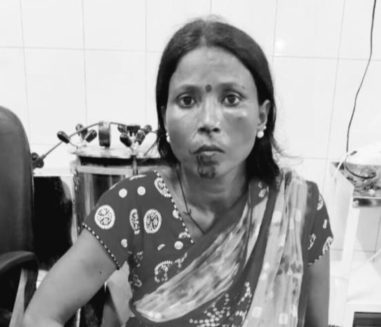 आदित्यपुर में महिला से मारपीट, बचाने आए पति और बेटी भी हुए घायल…