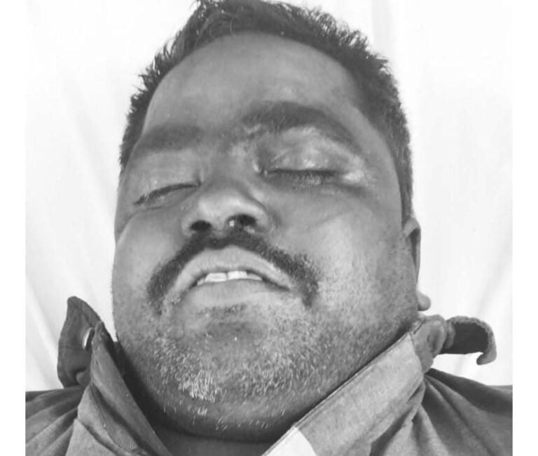 जमशेदपुर में महिंद्रा शोरूम के शटर का काम करने के दौरान करंट की चपेट में आया वेल्डर…