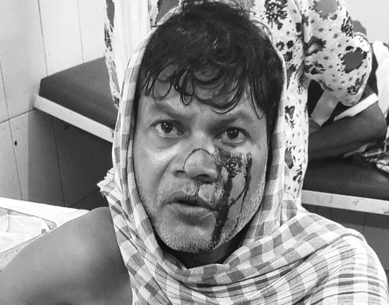 जमशेदपुर में घरेलू विवाद बना हिंसक, पत्नी ने झाड़ू और पत्थर से किया हमला, पति अस्पताल में भर्ती…
