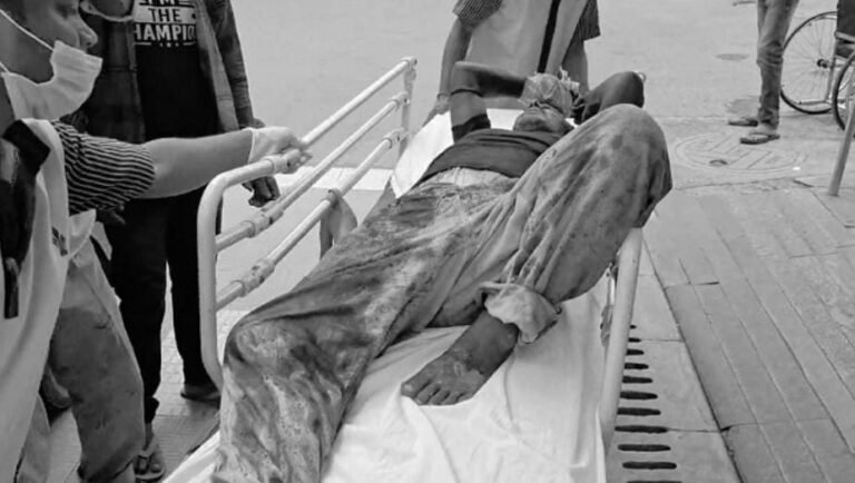 बड़ी लापरवाही! जमशेदपुर में वेल्डिंग के दौरान सिलेंडर फटा, मजदूर गंभीर रूप से घायल…