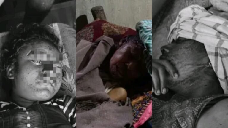 जमशेदपुर ग्रामीण क्षेत्र! कोवाली में घर में घुसकर हमला, एक बुजुर्ग महिला की मौत, दो युवतियां गंभीर रूप से घायल…