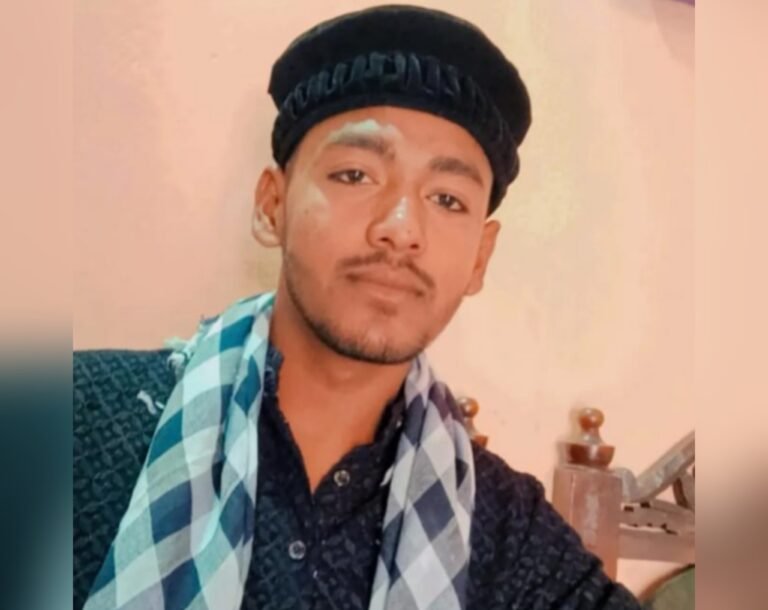 Jamshedpur: गोलमुरी गोल्फ ग्राउंड के सामने हुए सड़क हादसे में गंभीर रूप से घायल युवक ने तोड़ा दम…