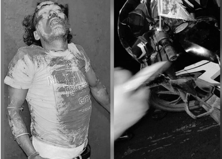 फिर एक बार सड़क में बने गड्ढों ने किया घायल!! कांड्रा में गड्ढों की वजह से बाइक सवार गिरा…