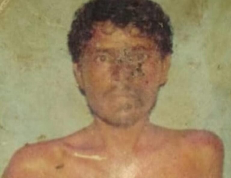 पटमदा में सांप के काटने से दिव्यांग युवक की मौत, परिवार पर टूटा दुखों का पहाड़…