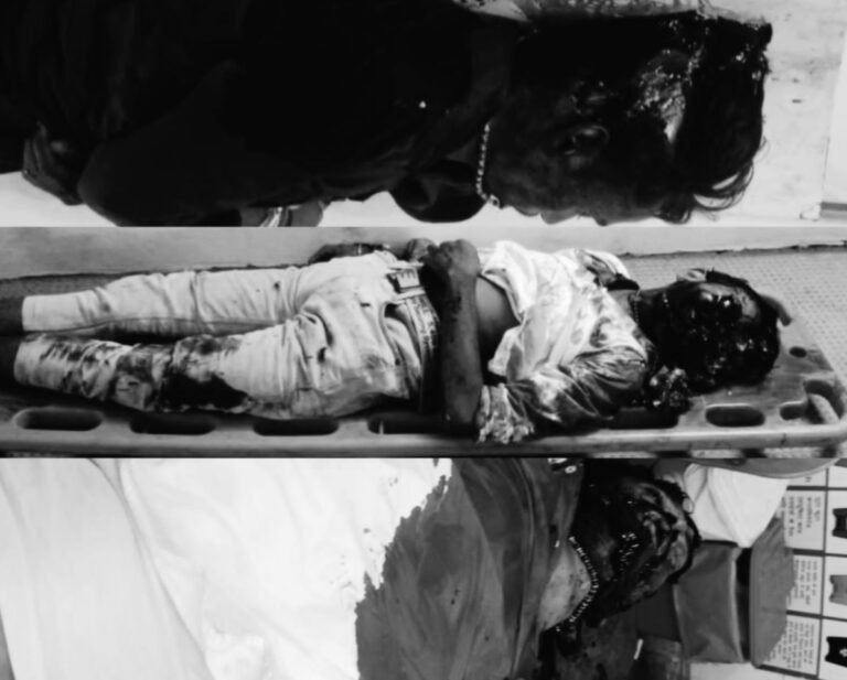 Saraikela: राजनगर में दर्दनाक सड़क हादसा, जमशेदपुर के तीन युवकों की मौके पर ही मौत…