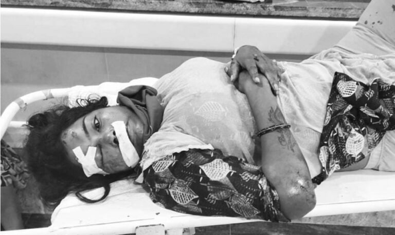 Jamshedpur: बिष्टुपुर में अज्ञात वाहन की टक्कर से स्कूटी सवार युवती गंभीर रूप से घायल…