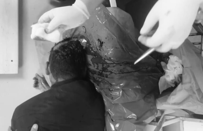 Seraikela-Kharsawan : कपाली में छिनतई की कोशिश के बाद मानगो के युवक पर चाइना चापड़ से हमला…