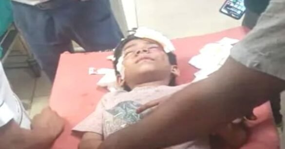 गोलमुरी में स्कूटी सवार बदमाश की लूट की कोशिश नाकाम, मां-बेटा घायल