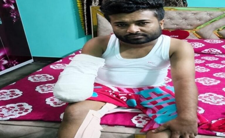JAMSHEDPUR : टाटा स्टील कलर्स में ड्यूटी के दौरान बड़ा हादसा मशीन की चपेट में आने से कर्मचारी का हाथ कटा