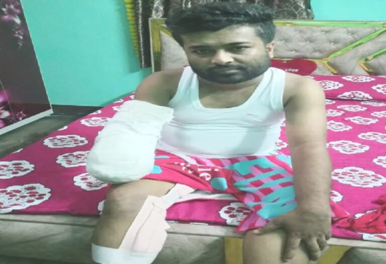 जमशेदपुर न्यूज: टाटा स्टील कलर्स में हादसे में कर्मचारी का हाथ कटा, परिवार ने लिखित आश्वासन की मांग की